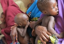 UNICEF: 11m Nigerian Children Are Malnourished