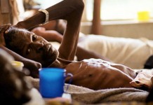 TWO DISEASES, ONE PATIENT…