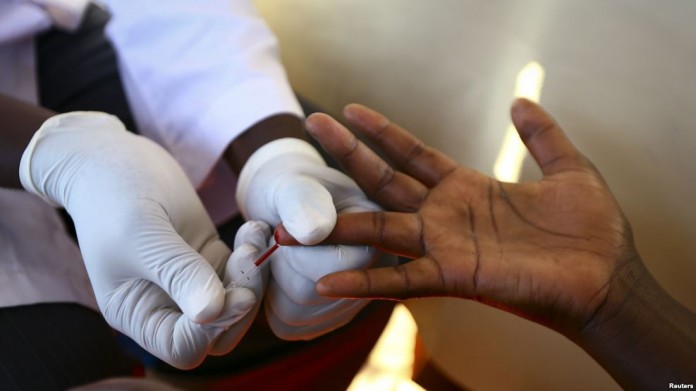 hiv-test