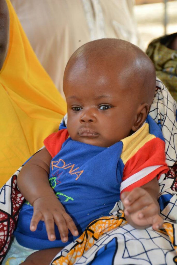 Maaruf abdussalam 3 months hydrocephalus my - THEWILL NEWS MEDIA