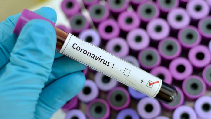 corona-virus-deadly-_012620015549