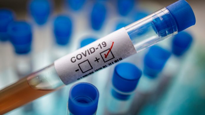 COVID-19 Positive Test