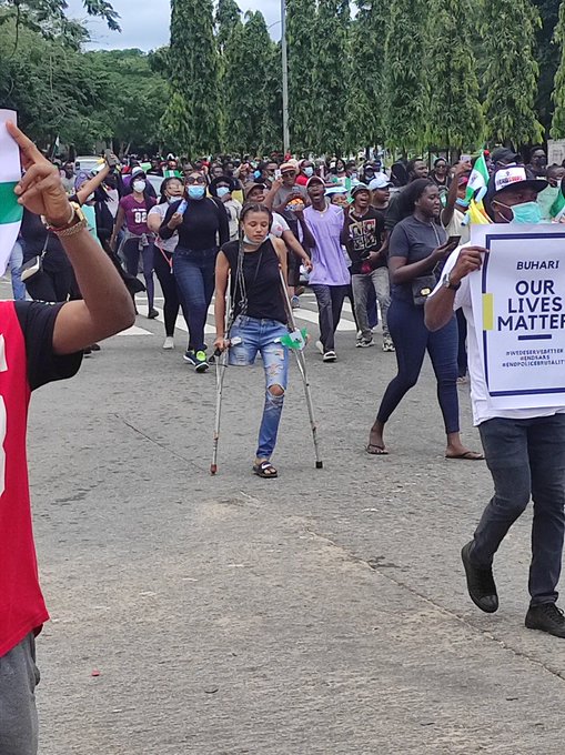 Prosthetic Leg For #EndSARS Protester 2 - THEWILL NEWS MEDIA