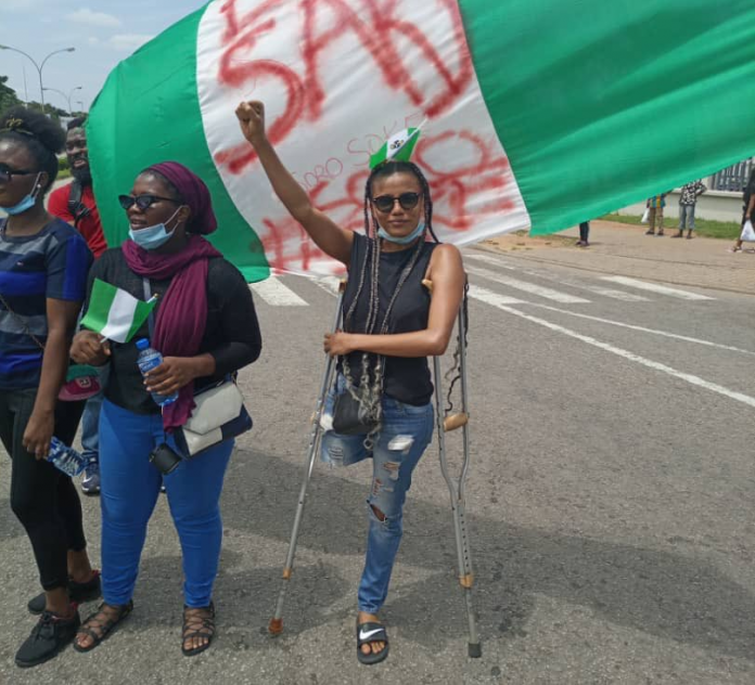 Prosthetic Leg For #EndSARS Protester