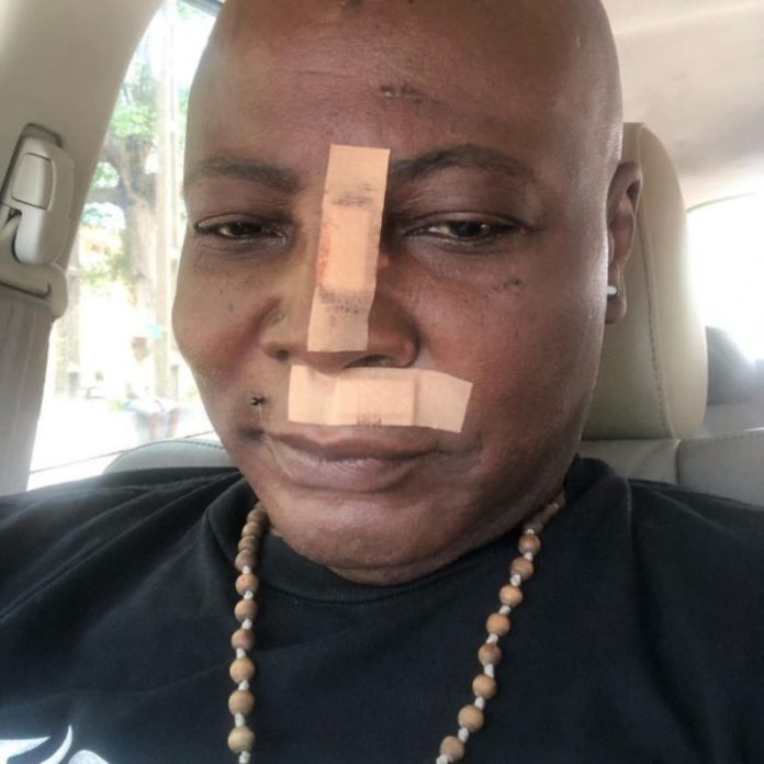 Charly Boy Accident Charly Boy