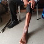 Echoes Of 4 Years’ Pain From The Survivors Of A Collapsed Church Akwa Ibom