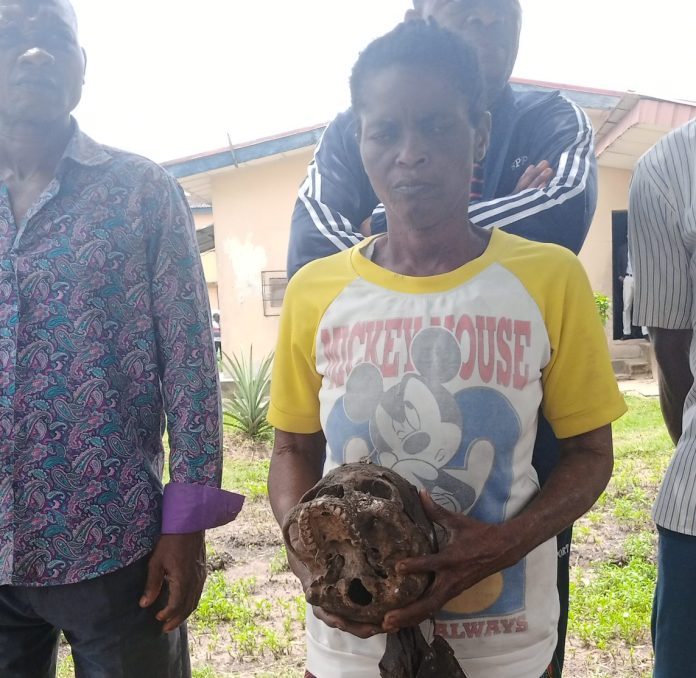 Eseme James will the human skull