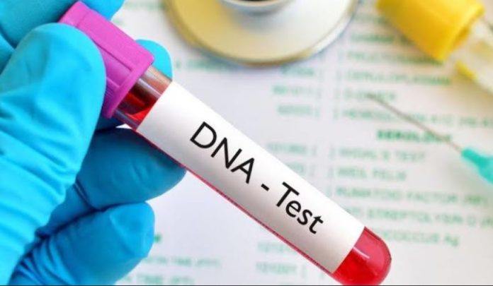 dna DNA TEST