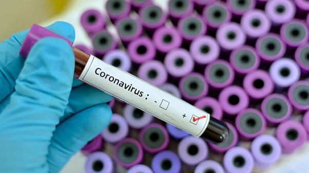 COVID-19Test