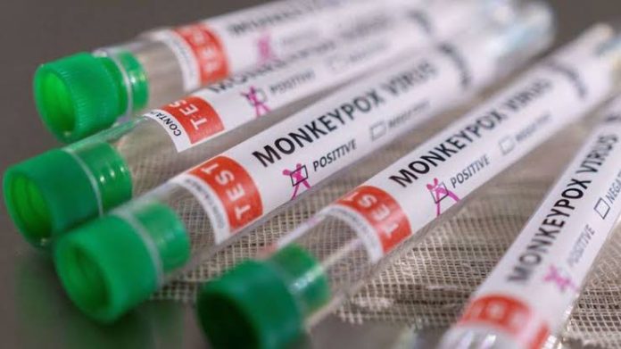 Monkeypox Monkeypox