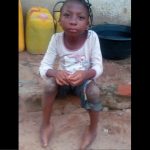 Disabled Benue Girl Appeals To Gov Ortom For Medical Assistance, Fees