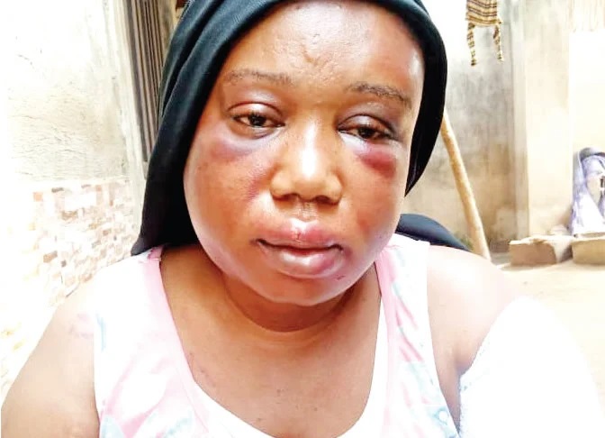 Police Launch Manhunt For Husband Of Battered Journalist In Adamawa