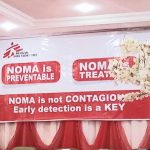 NOMA Disease: MSF Seeks Preventable Measures Among Nigerians