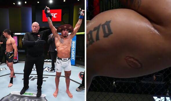 Ufc severino bites Lima