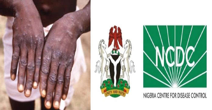 NCDC mpox NCDC - mpox