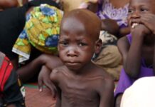 THEWILL EDITORIAL: Saving Future Generations of Nigerians from Malnutrition Malnutrition