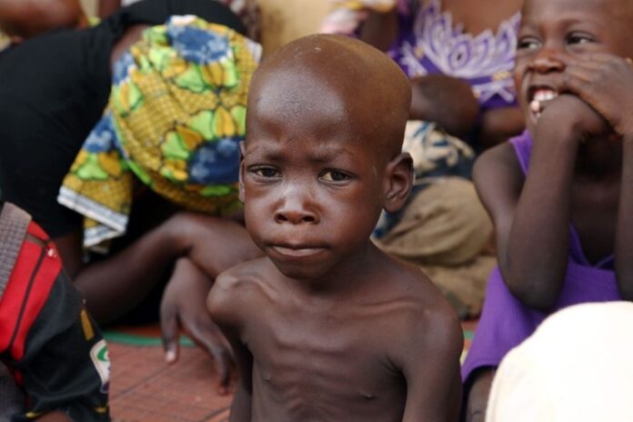 Malnutrition